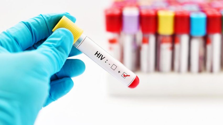 HIV and STD testing
